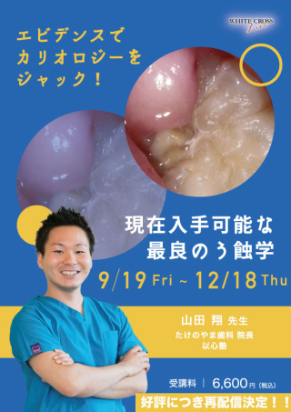 エビデンスでカリオロジーをジャック！現在入手可能な最良のう蝕学【再配信】の画像です。