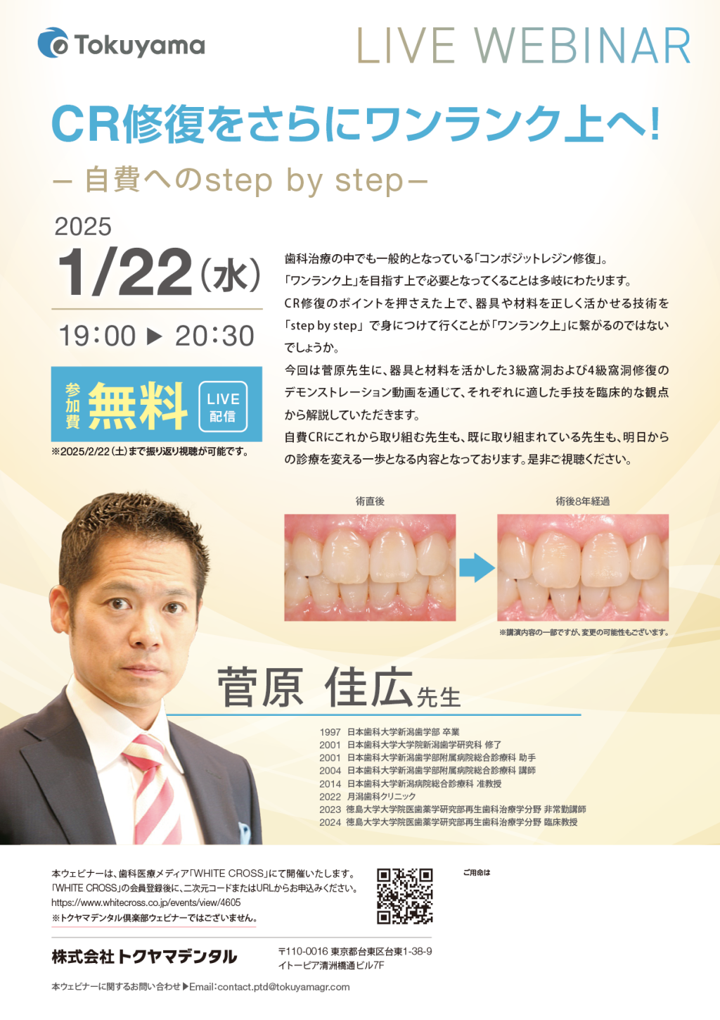 録画配信］CR修復をさらにワンランク上へ！〜自費へのstep by