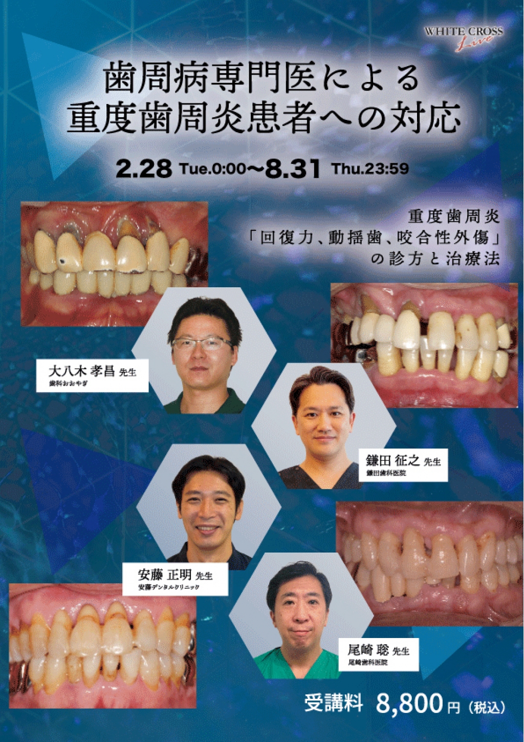 臨床歯周病学 JACP 日本臨床歯周病学会