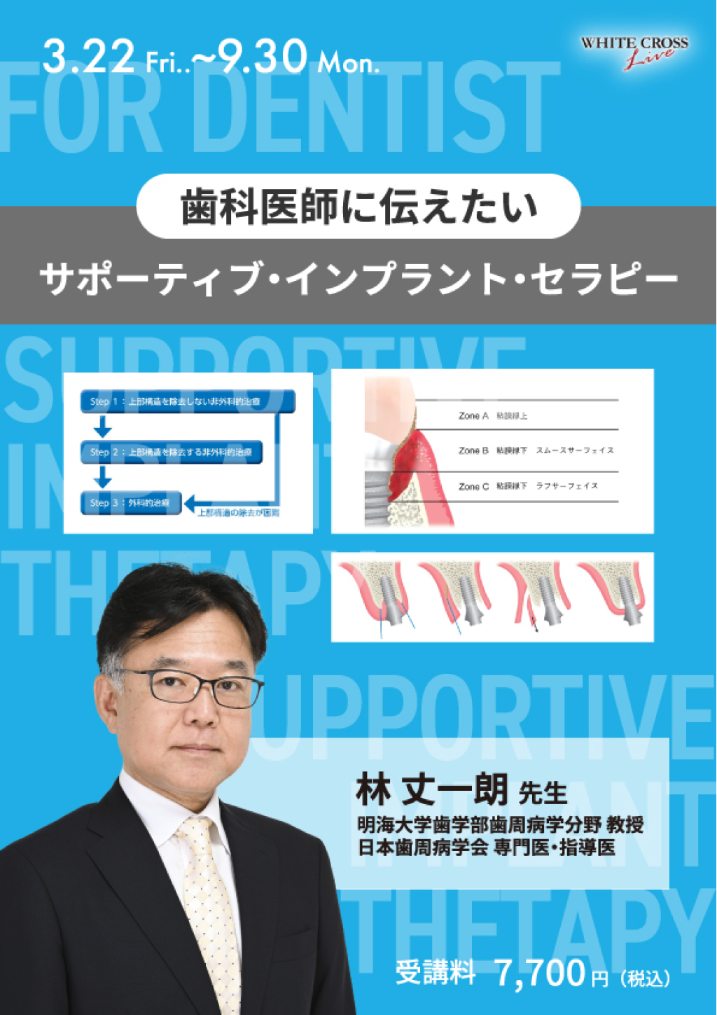 増補新版 インプラントセラピー 増補新版 インプラントセラピー