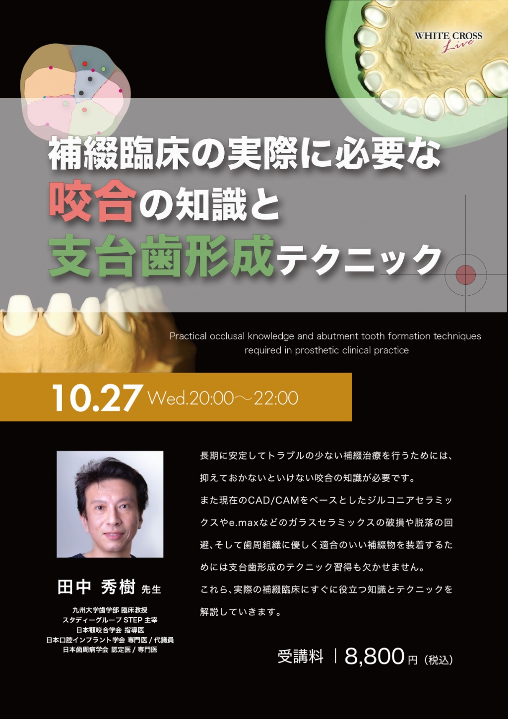 支台歯形成のベーシックテクニック 支台歯形成のベーシックテクニック| 歯科総合出版社 デンタル