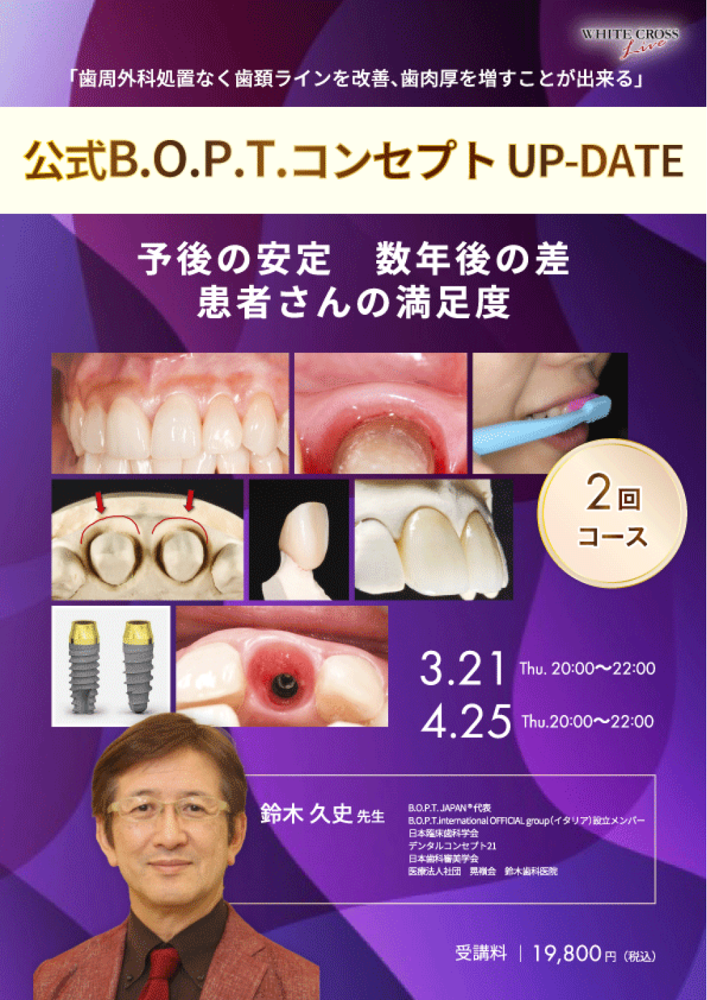 録画配信］公式B.O.P.T.コンセプトUP-DATE 予後の安定 数年後の