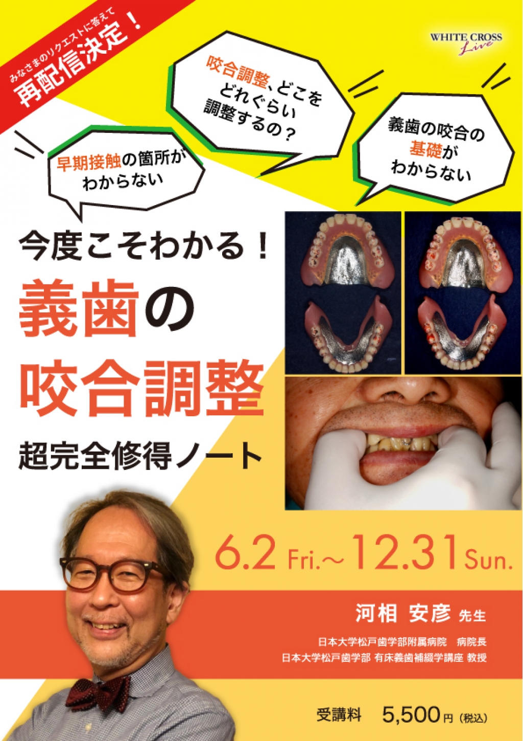 VOD］今度こそわかる！義歯の咬合調整 超完全修得ノート【再配信