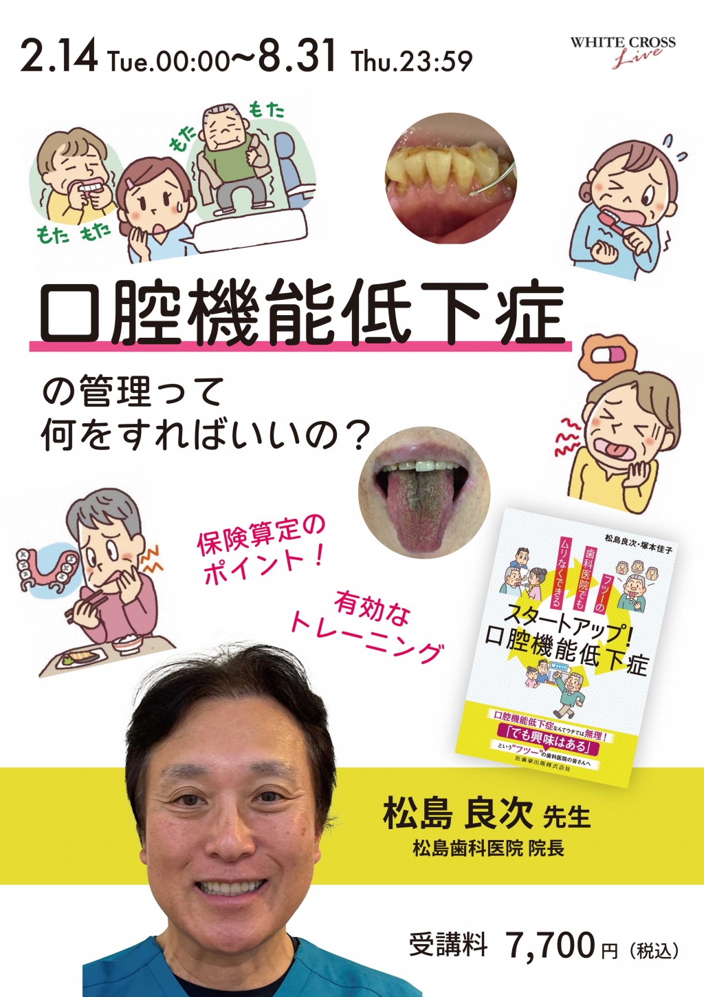 VOD］口腔機能低下症の管理って何をすればいいの？ | WHITE CROSS