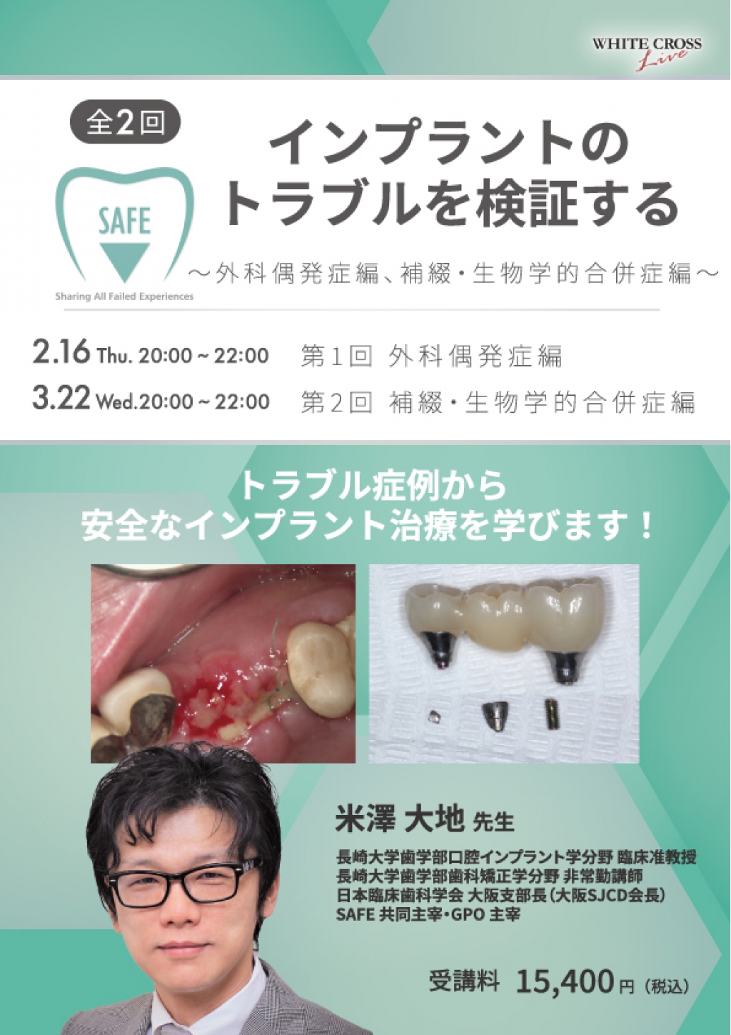 誰もが遭遇するインプラント補綴の合併症 誰もが遭遇するインプラント補綴の合併症 原因・対処法・予防策
