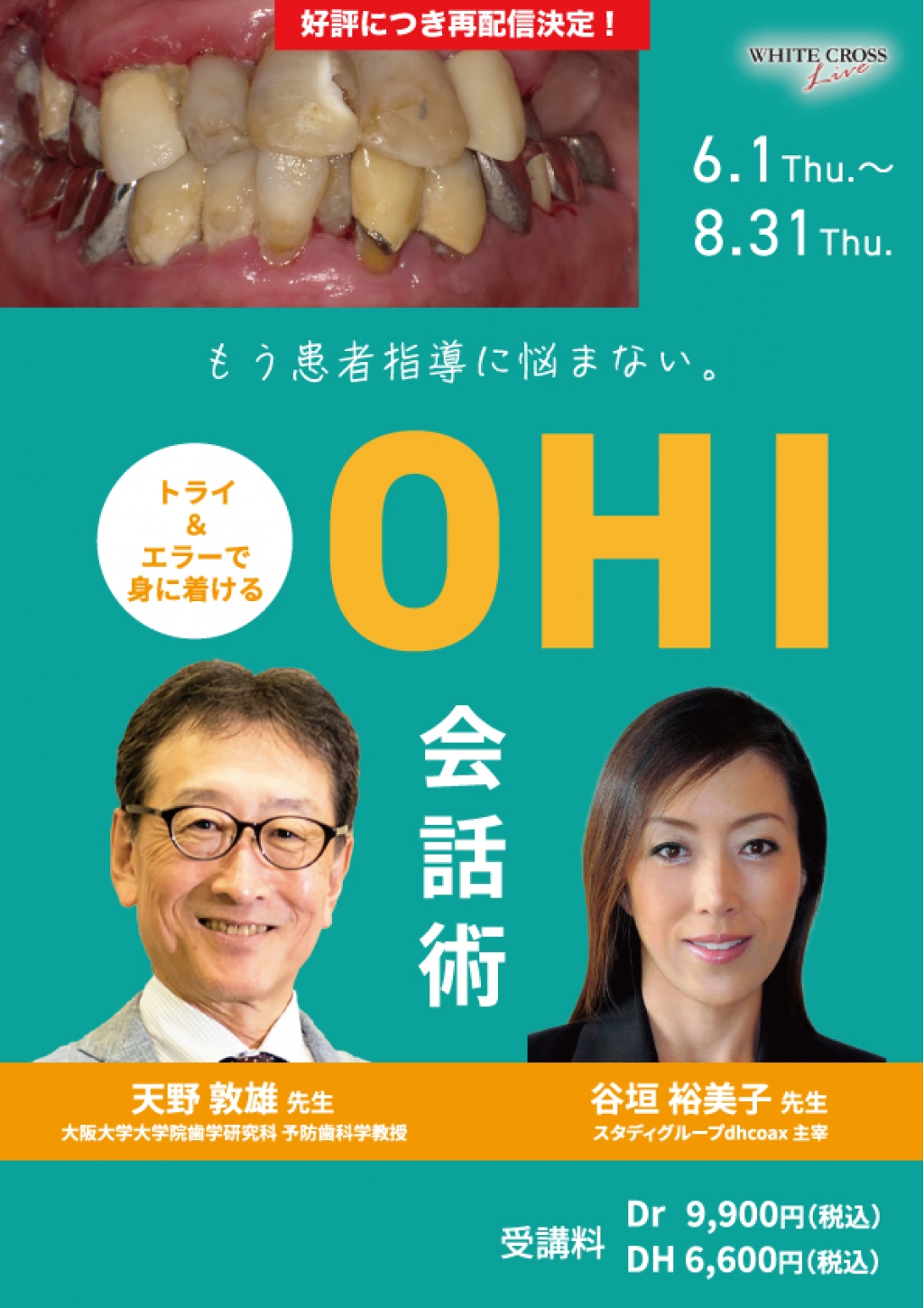 VOD］もう患者指導に悩まない。トライ＆エラーで身に着けるOHI会話術
