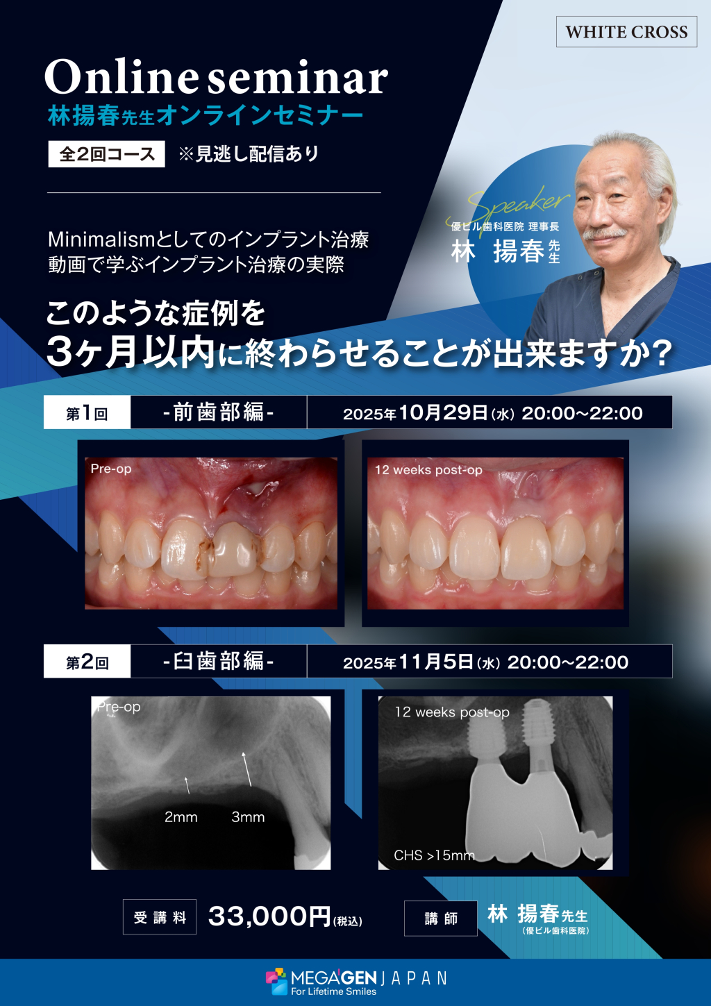 ［録画配信］Minimalismとしてのインプラント治療の画像です。