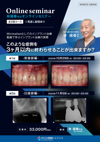 ［録画配信］Minimalismとしてのインプラント治療の画像です。