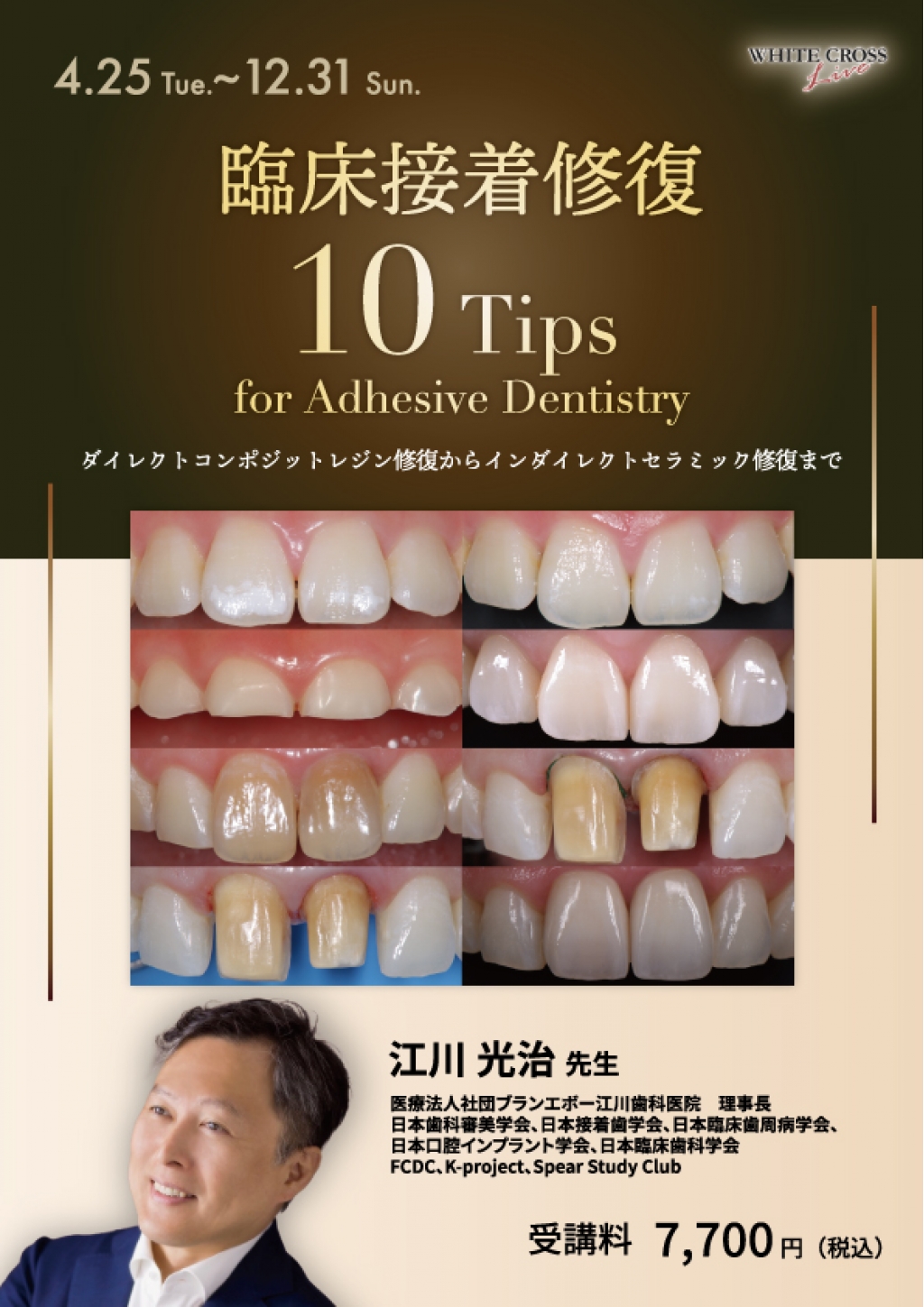 VOD］臨床接着修復10Tips for Adhesive Dentistry | WHITE CROSS