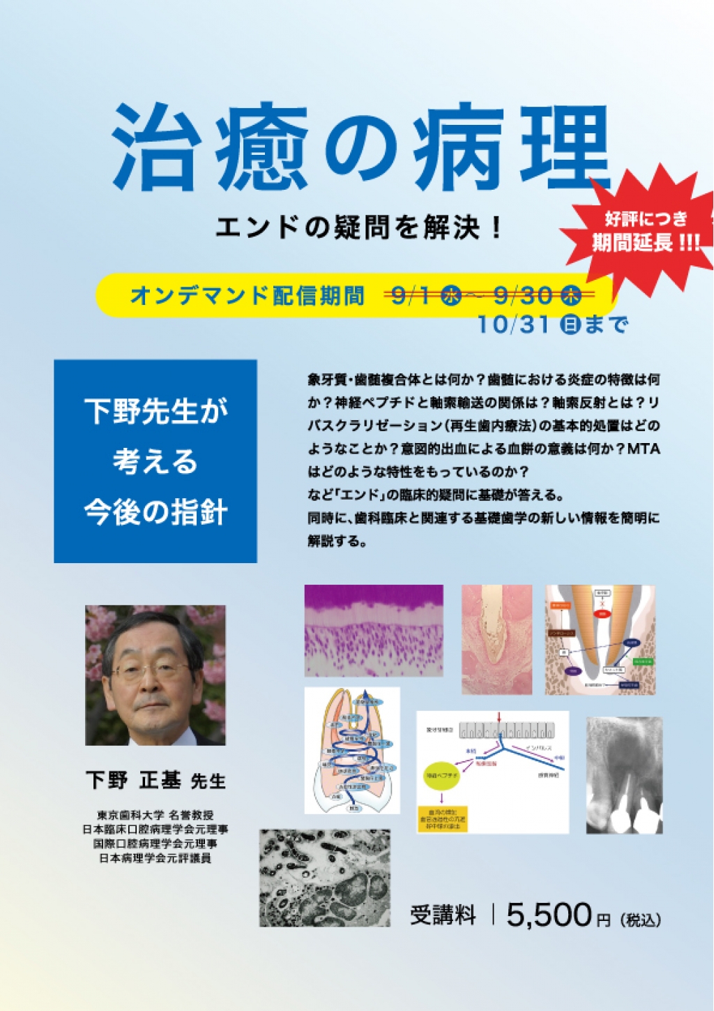 Web］治癒の病理 エンドの疑問を解決！～下野先生が考える今後の指針