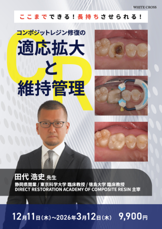 コンポジットレジン修復の適応拡大と維持管理の画像です。