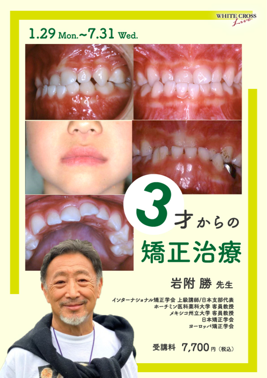 おうち矯正Q&A: 0歳から不正咬合を予防する“もっと”身近な指導法