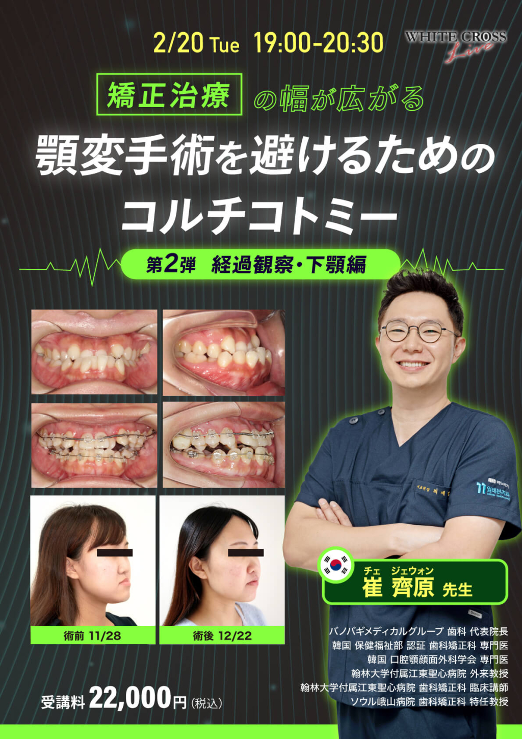 プチ矯正のススメ　歯科矯正セミナー　レジュメ Amazon.co.jp: プチ矯正のススメ : 相原克偉: 本