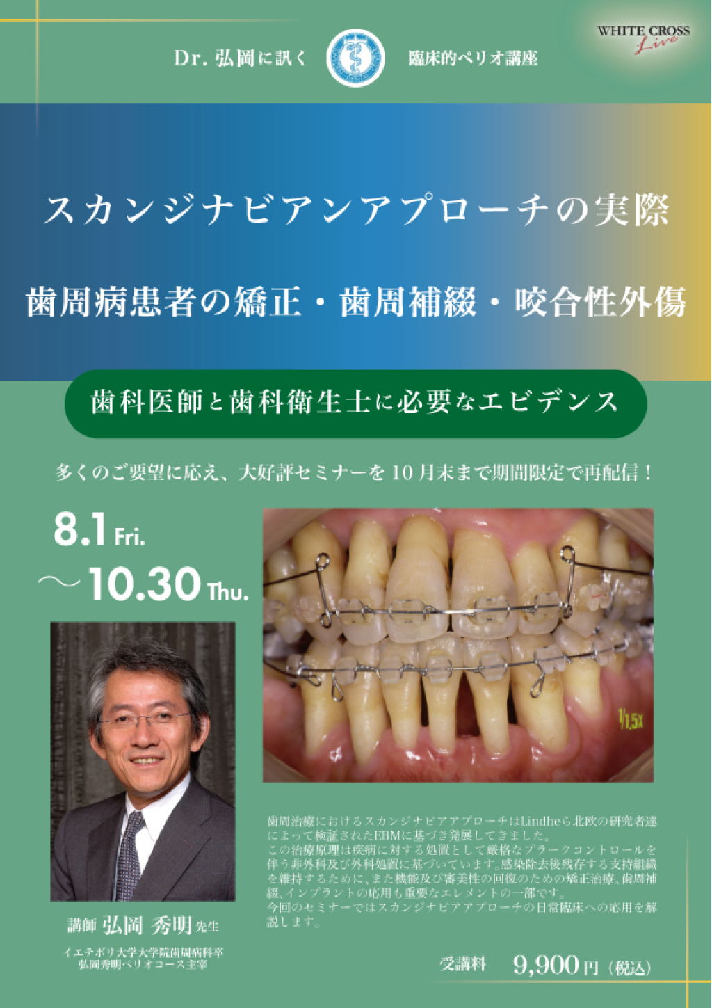 Dr.弘岡に訊く臨床的ペリオ講座 スカンジナビアンアプローチの実践 Dr.弘岡に訊く臨床的ペリオ講座 スカンジナビアンアプローチの