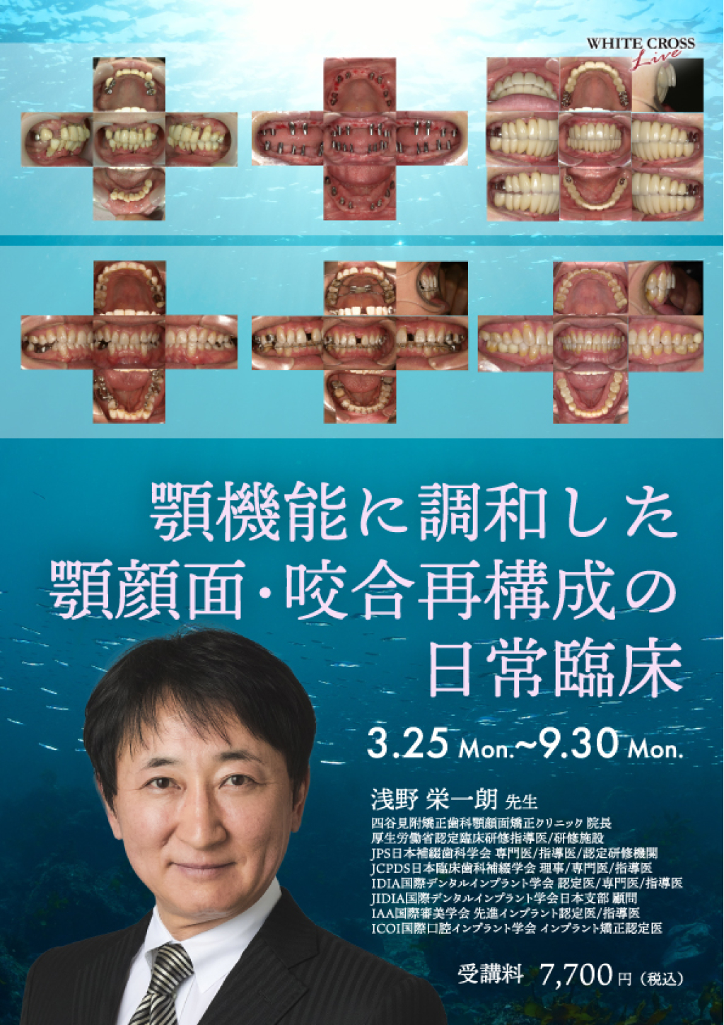 VOD］顎機能に調和した顎顔面・咬合再構成の日常臨床 | WHITE CROSS