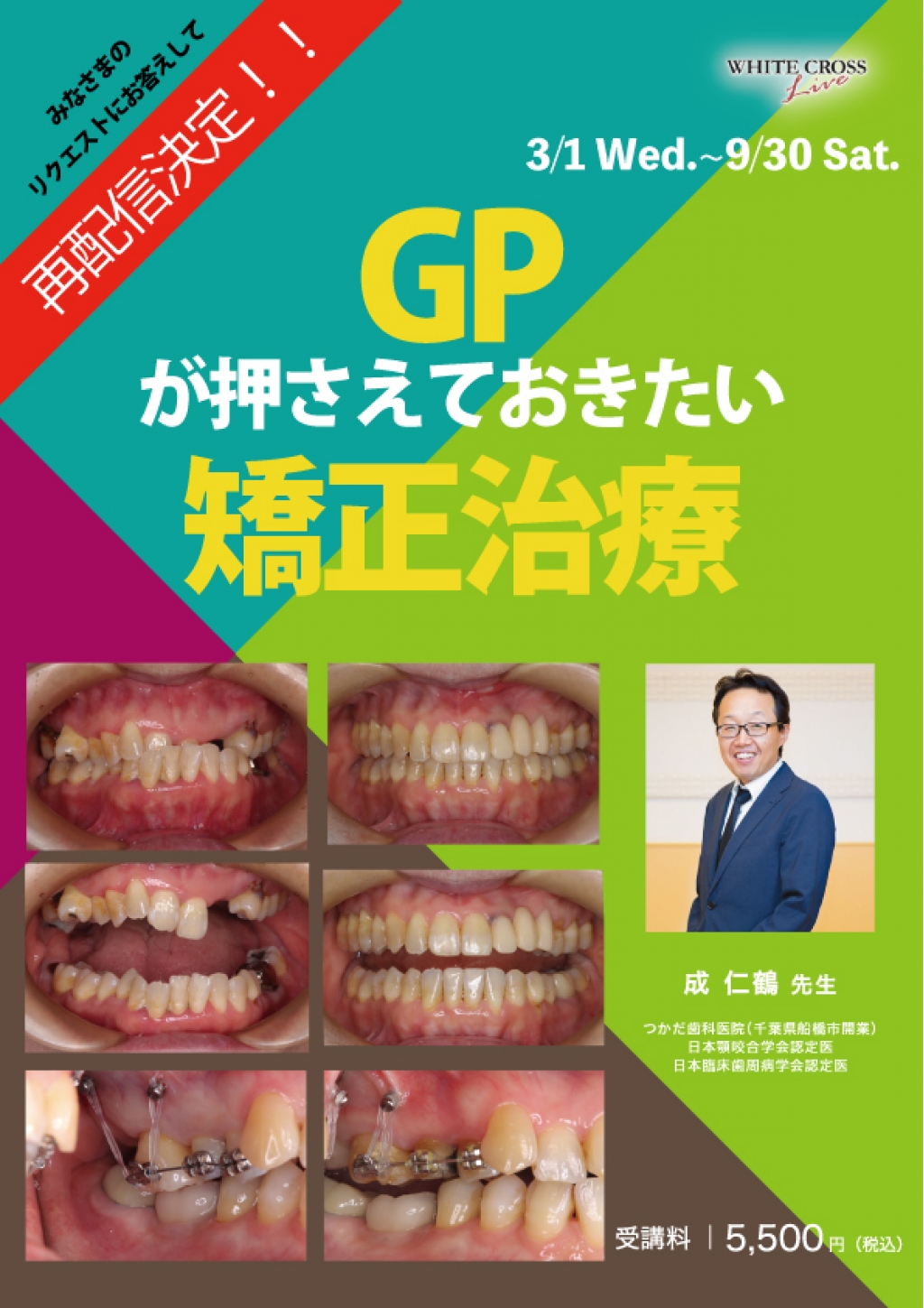 VOD］GPが押さえておきたい矯正治療【再配信】 | WHITE CROSS
