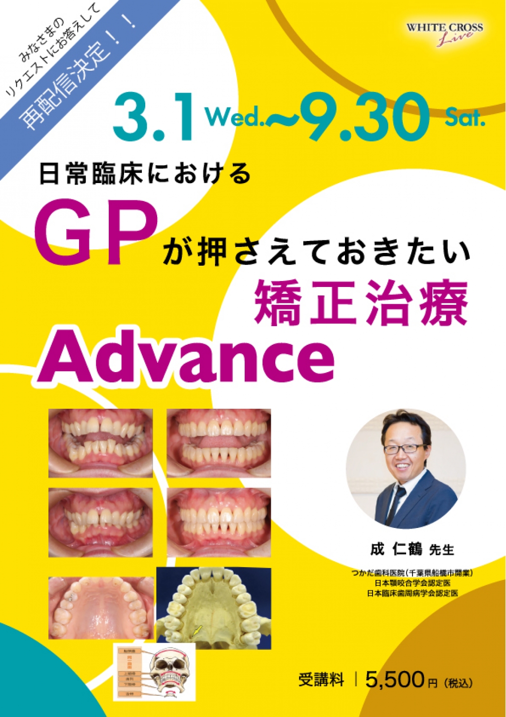 VOD］日常臨床におけるGPが押さえておきたい矯正治療 Advance【再配信