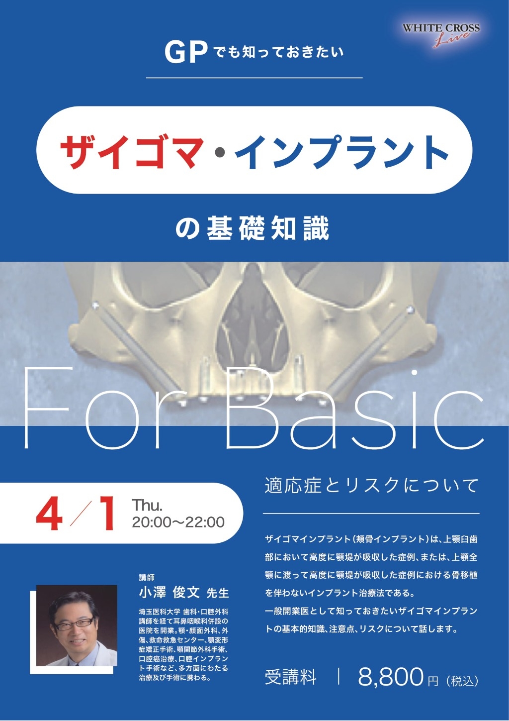 録画配信］GPでも知っておきたいザイゴマ ・インプラントの基礎知識