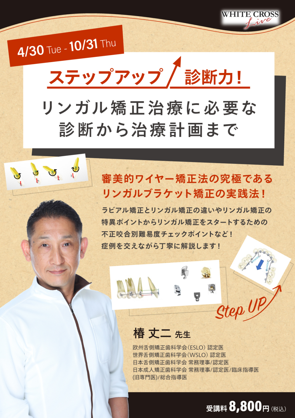 Amazon 産業・研究開発用品 実践的リンガルブラケット