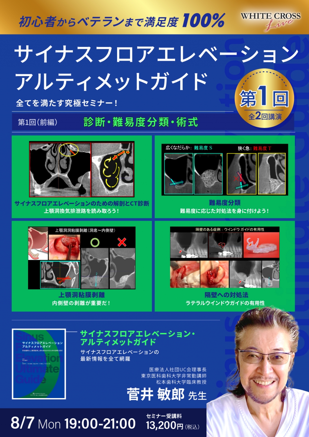 録画配信］サイナスフロアエレベーション アルティメットガイド 全てを