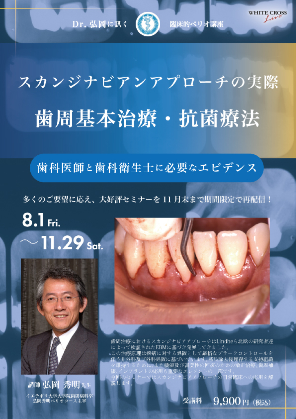 【裁断済】Dr.弘岡に訊く臨床的ペリオ講座 スカンジナビアンアプローチの実践 現代有機化学 下 第4版 | K.P.C.Vollhardt, N.E.Schore, 大嶌