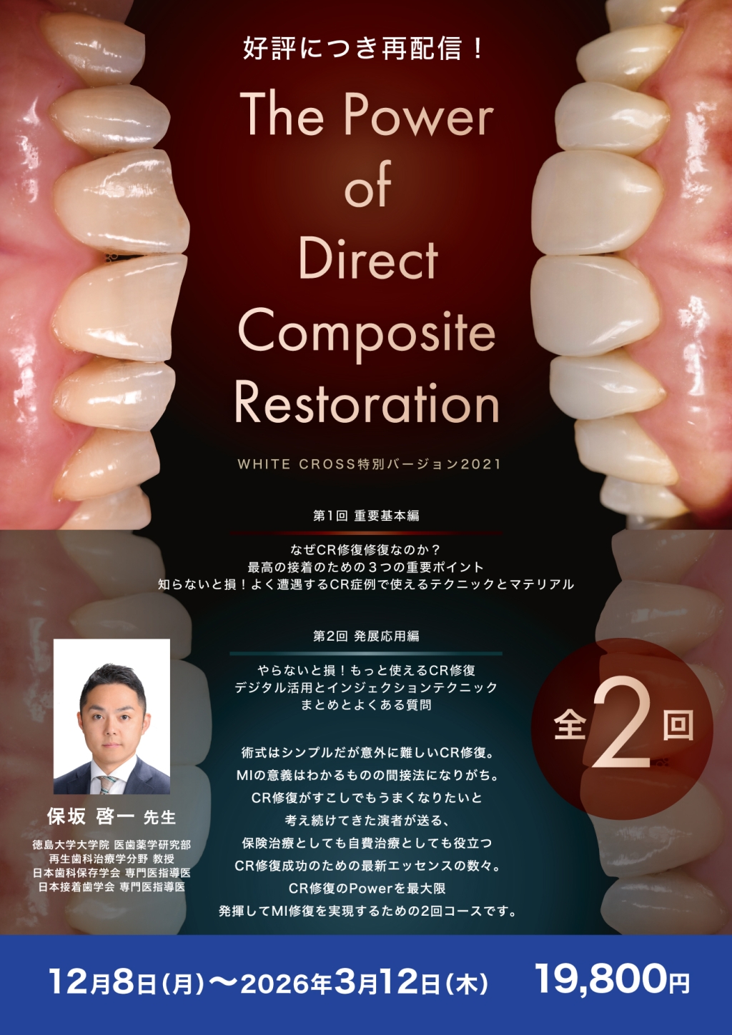 The Power of Direct Composite Restoration【再配信】 | WHITE CROSS