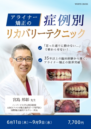 8種類のマウスピース矯正装置を一括比較！〜あなたに合うのはどの