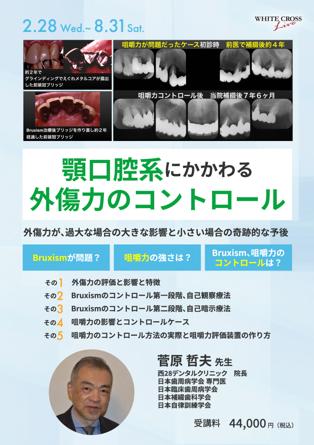 外傷歯の診断と治療【裁断済】 裁断済】シリーズ MIに基づく歯科臨床 外傷歯の診断と治療<増補新版>