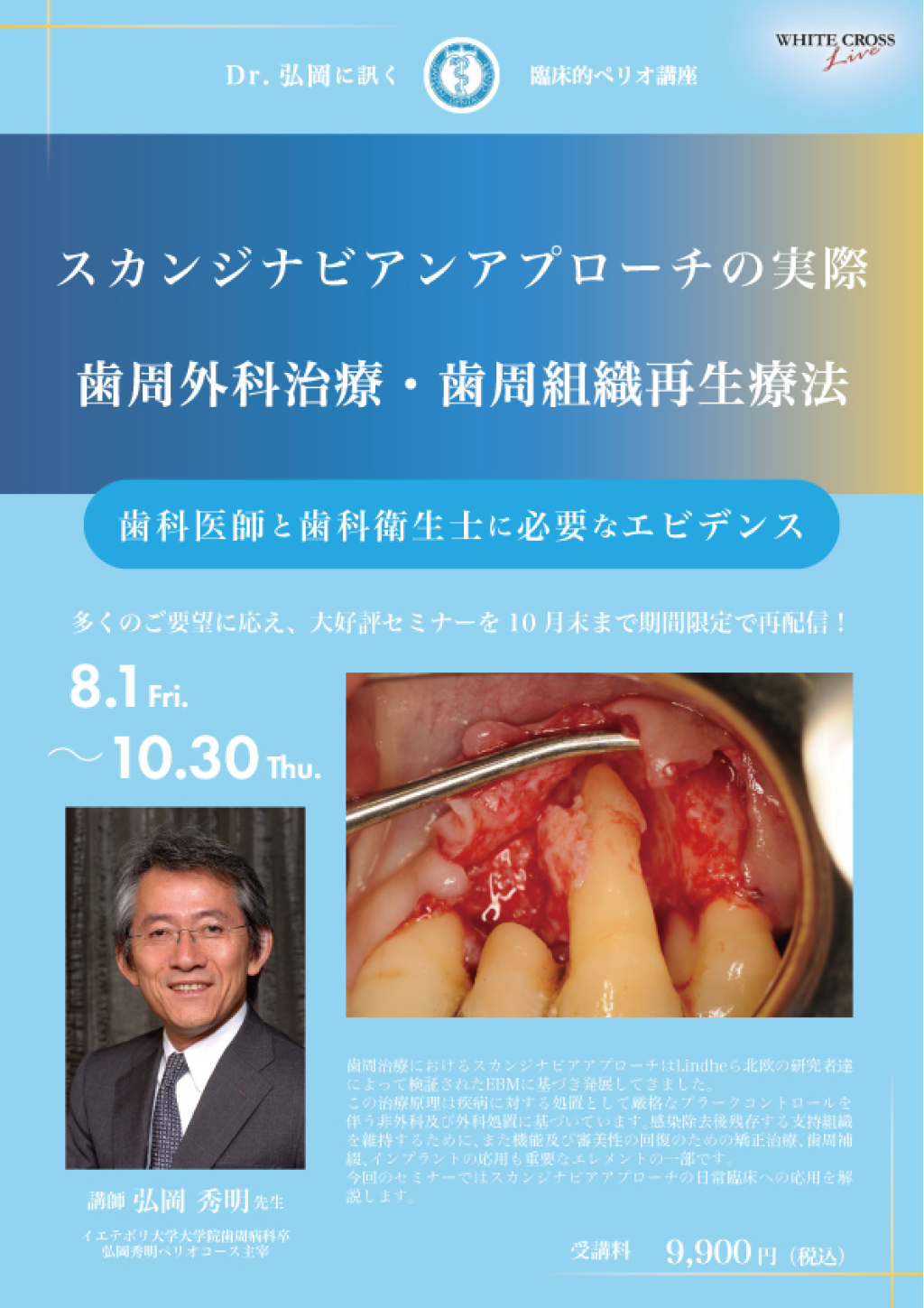 Dr弘岡に訊く臨床的ペリオ講座スカンジナビアンアプローチの実践 Dr.弘岡に訊く臨床的ペリオ講座1歯科医師と歯科衛生士に必要な