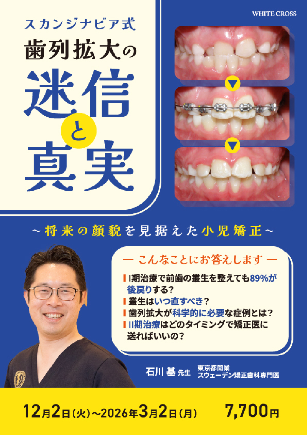 スカンジナビア式歯列拡大の迷信と真実〜将来の顔貌を見据えた小児矯正〜の画像です。