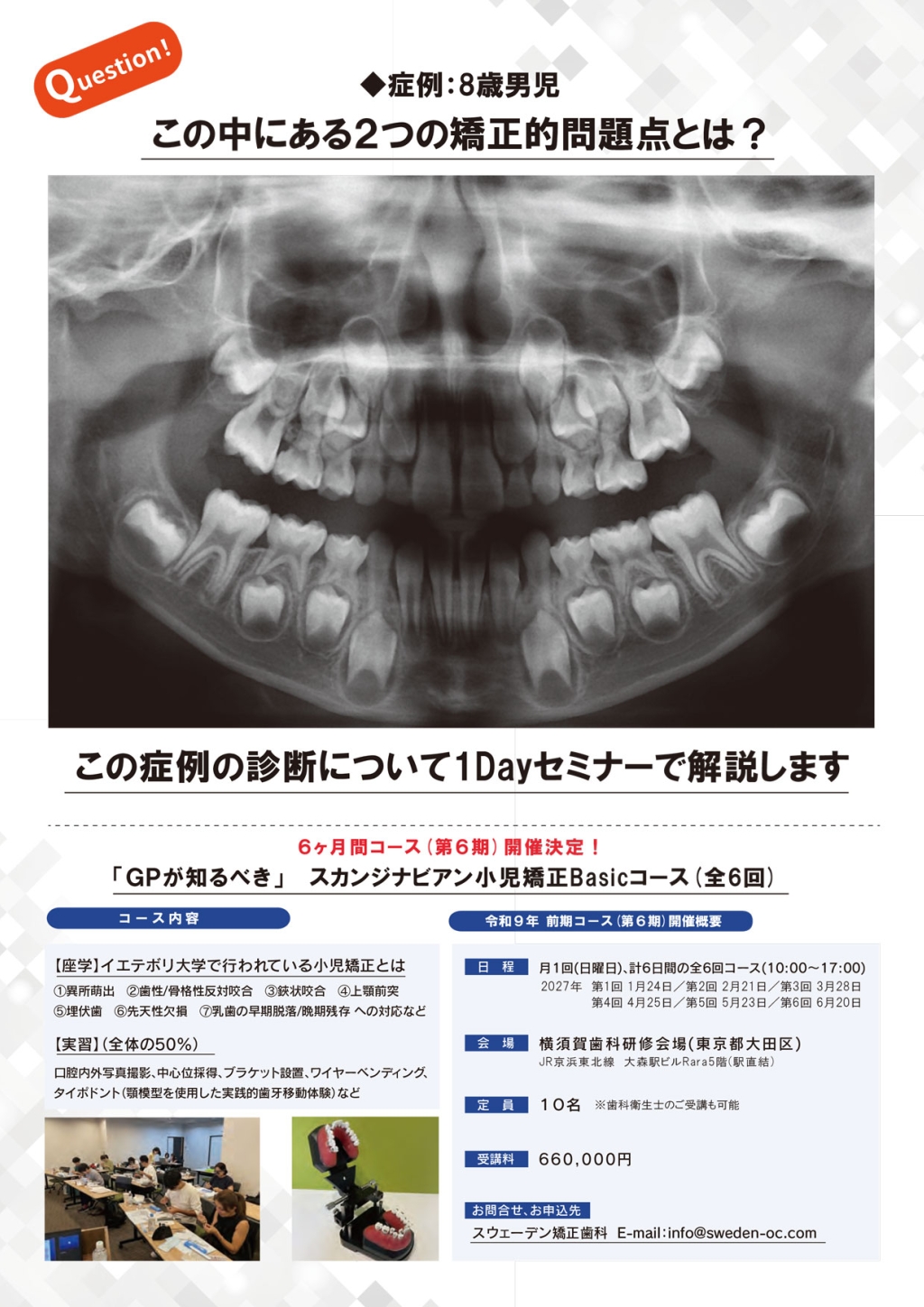 GPが知るべき」小児矯正診断1DAYセミナー | WHITE CROSS