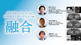 サイナスフロアエレベーション アルティメットガイド 全てを満たす究極