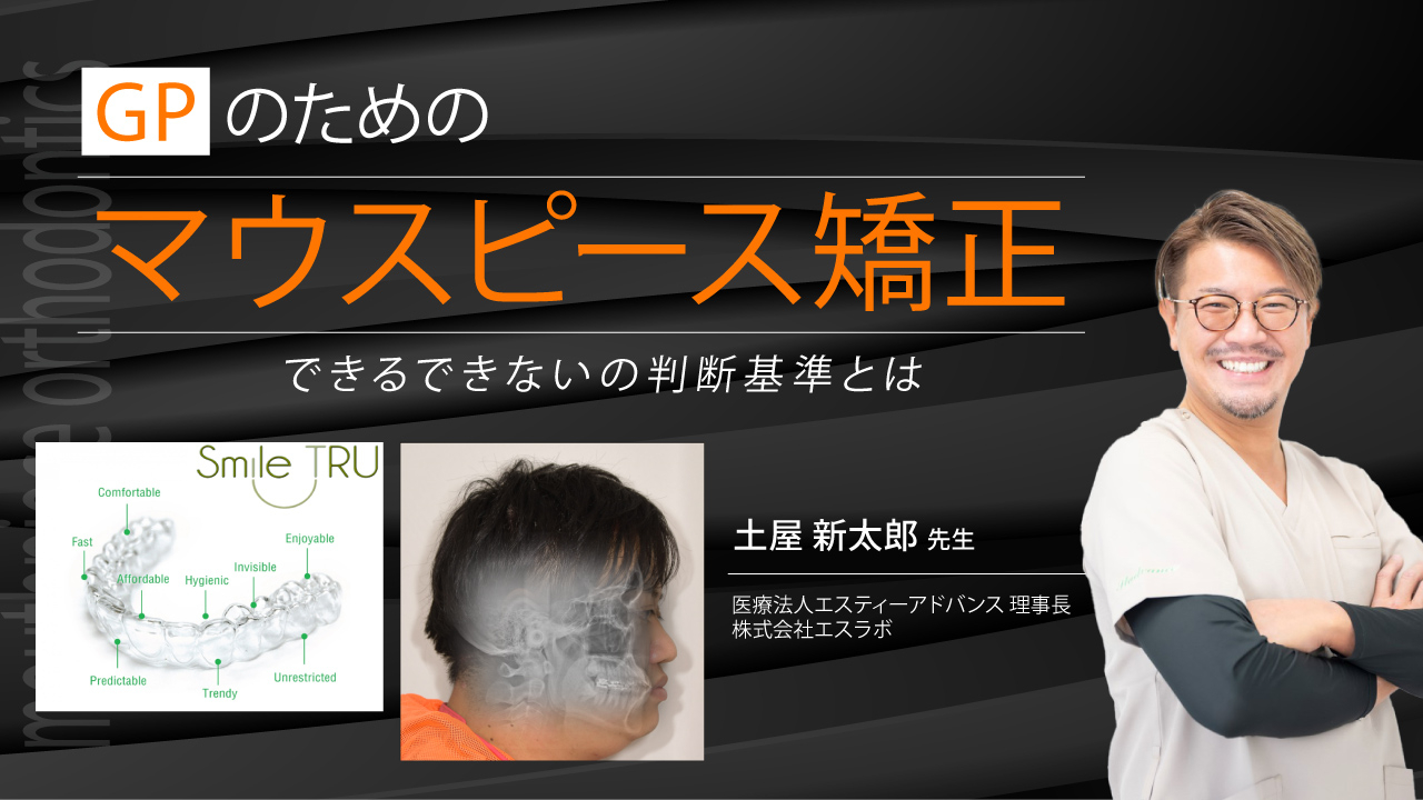 GPのためのマウスピース矯正～できるできないの判断基準とは～の画像です。