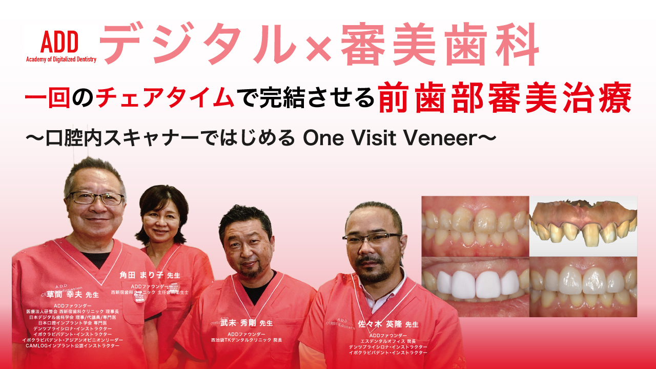一回のチェアタイムで完結させる前歯部審美治療〜口腔内スキャナーではじめるOne Visit Veneer〜の画像です。