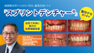 補綴難症例でも2回目に咬合、審美回復できる「スプリントデンチャー®️」〜自院で安価に製作の自費補綴装置〜の画像です。