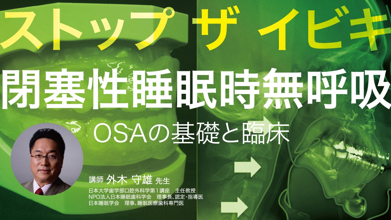 ストップ・ザ・イビキ 閉塞性睡眠時無呼吸OSAの基礎と臨床