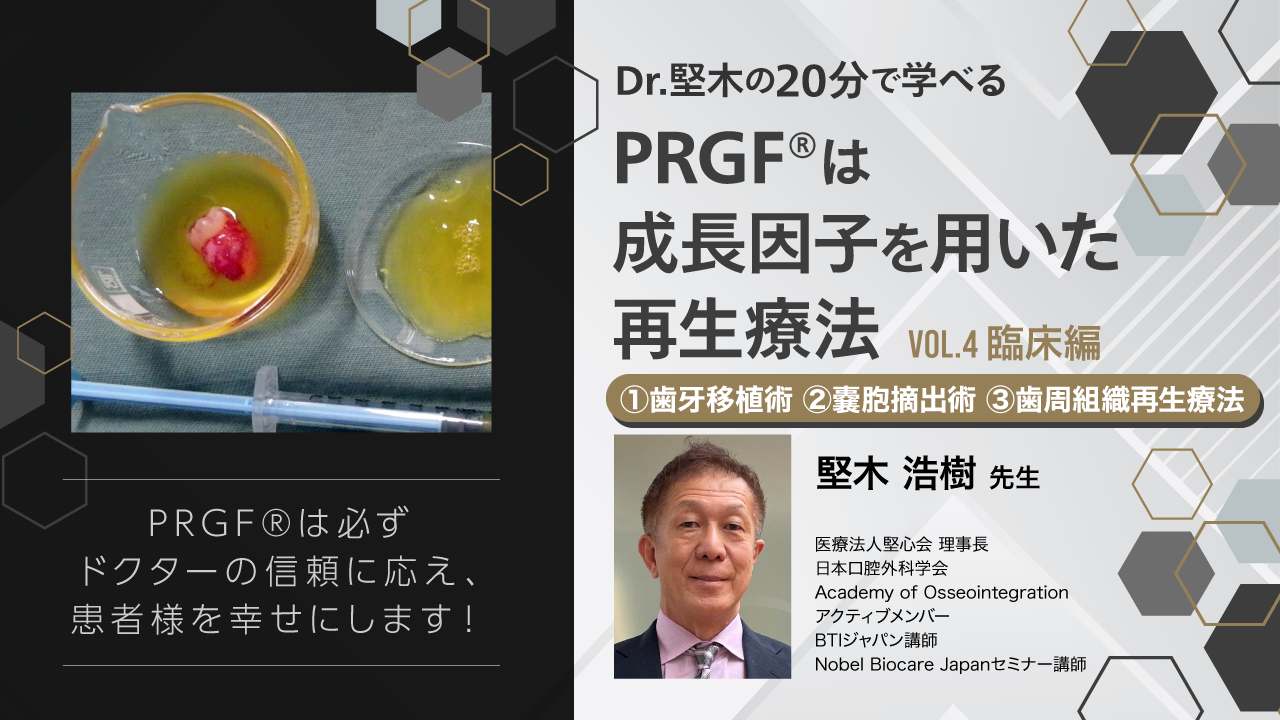 Dr.堅木の20分で学べる〜PRGF®は成長因子を用いた再生療法【Vol.4 ①歯牙移植術 ②嚢胞摘出術 ③歯周組織再生療法】〜 | WHITE  CROSS