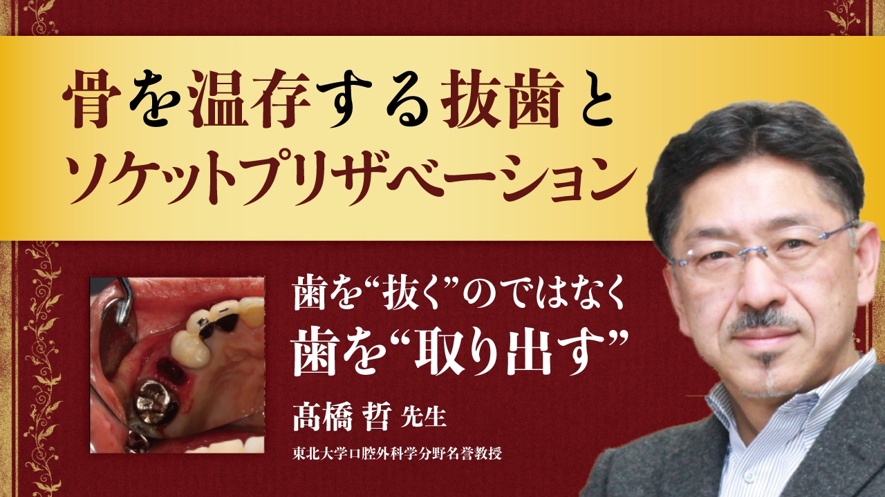 骨を温存する抜歯とソケットプリザベーション | WHITE CROSS