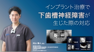 インプラント治療で下歯槽神経障害が生じた際の対応の画像です。