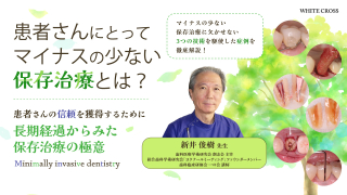 MIDの理念に沿った根面う蝕のマネジメント戦略 | WHITE CROSS