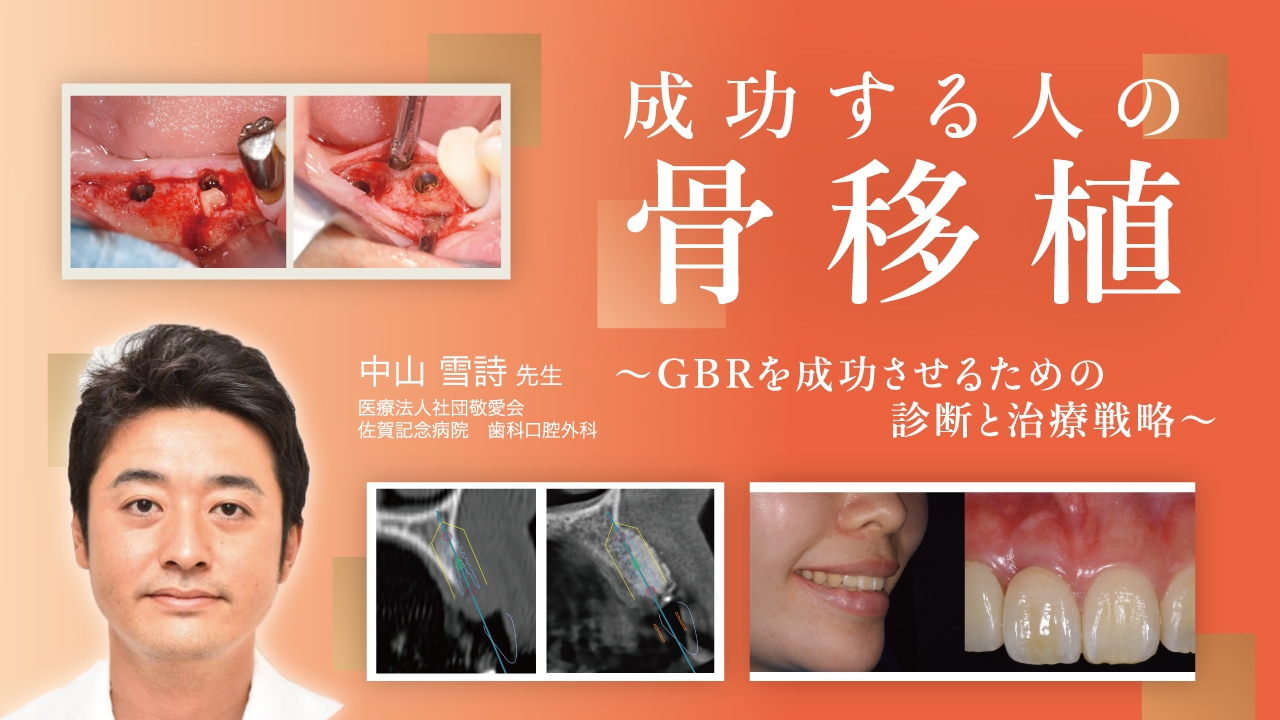 成功する人の骨移植〜GBRを成功させるための診断と治療戦略〜の画像です。