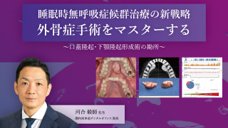 睡眠時無呼吸症候群治療の新戦略 外骨症手術をマスターする〜口蓋隆起・下顎隆起形成術の勘所〜の画像です。