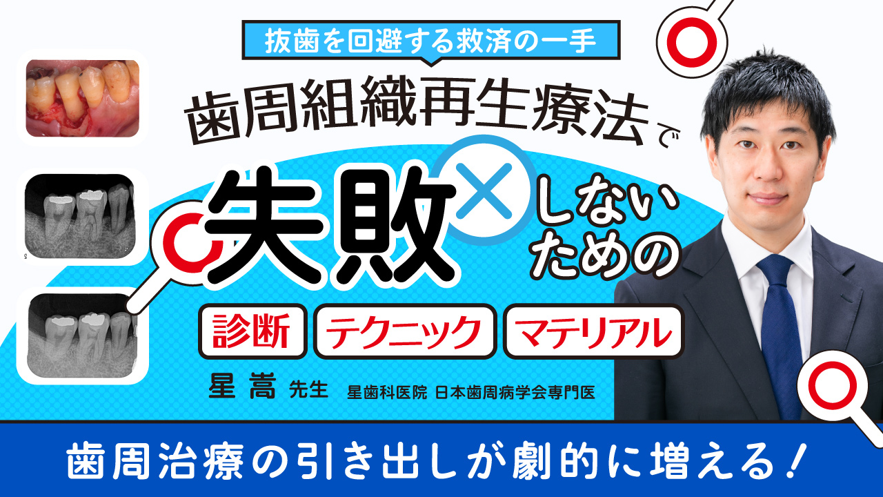 歯周組織再生療法で失敗しないための診断・テクニック・マテリアルの画像です。
