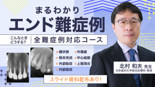 こんなときどうする？ 知って得するエンドの知識と治療法の画像です。