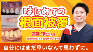 はじめての根面被覆〜基礎から学ぼう〜の画像です。