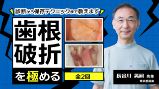 歯根破折を極めるの画像です。