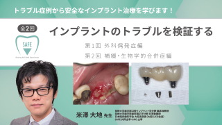 全2回 インプラントのトラブルを検証する〜外科偶発症編、補綴・生物学的合併症編〜の画像です。