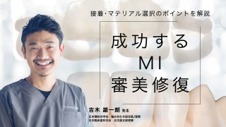 成功するMI審美修復の画像です。