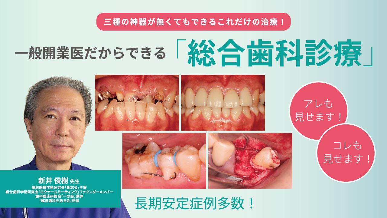 三種の神器が無くてもできるこれだけの治療！一般開業医だからできる「総合歯科診療」の画像です。