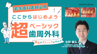 ここからはじめよう超ベーシック歯周外科の画像です。